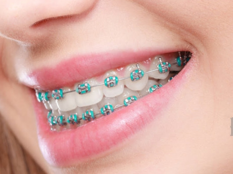 Foto de dr cesar matallana odontologia especializada - goias odonto sao luis ma