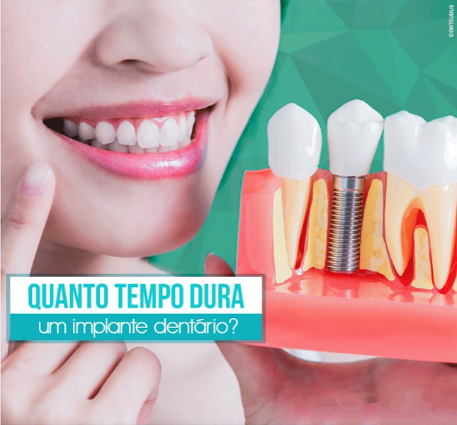 Foto 3 de dr cesar matallana odontologia especializada - goias odonto sao luis ma