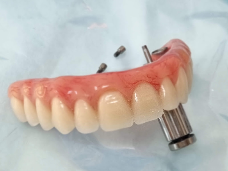 Foto 2 de Dr Christian Reis | Dentista em Barreto | Implantes dentários em Barreto, Niterói | Prótese Protocolo
