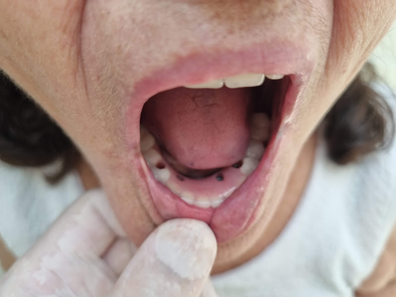 Foto 3 de Dr Christian Reis | Dentista em Barreto | Implantes dentários em Barreto, Niterói | Prótese Protocolo