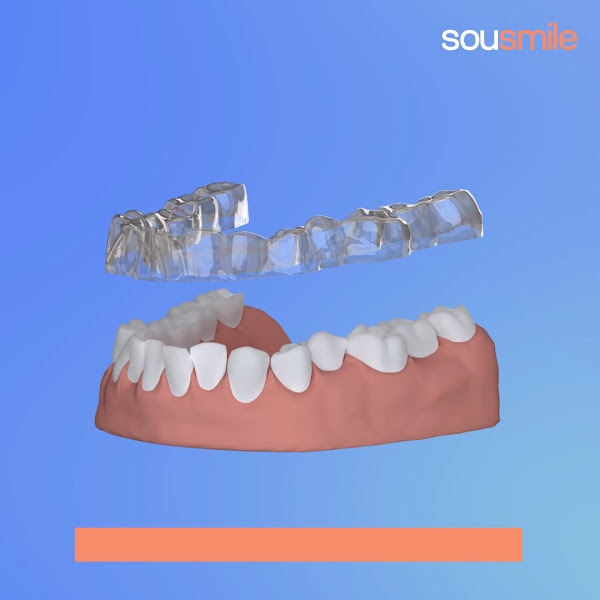 Foto 2 de Dr. Claudio Barufaldi - Ortodontista em Salto | Dentista em Salto