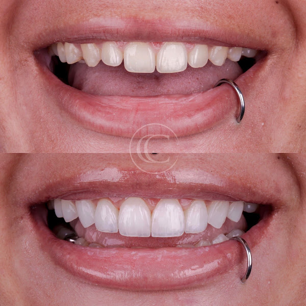 Foto 4 de Dr. Claudio Cerqueira - Cerqueira Clinic