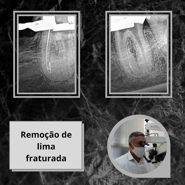 Foto 3 de Dr. Claudio Roberto Moreira - Endodontia com Microscopia