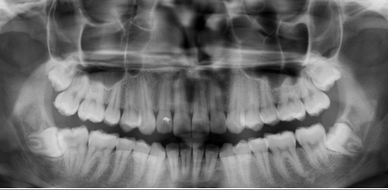 Foto 3 de Dr. Claudio Santana - Bucomaxilofacial - Cirurgião Dentista - Campo Grande-Ms