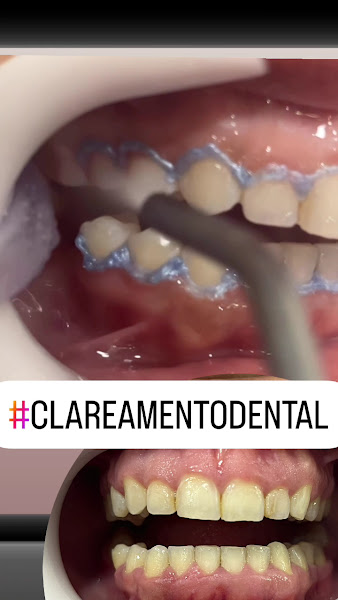 Foto 3 de Dr. Cleiton Veltri Dentista