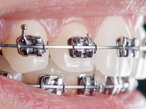 Foto 2 de Drª Cristiane Kern Chiapetti | Dentista | Ortodontia | Clínica Geral | Cirurgias | Palhoça |