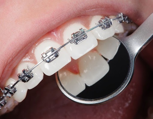 Foto 3 de Drª Cristiane Kern Chiapetti | Dentista | Ortodontia | Clínica Geral | Cirurgias | Palhoça |