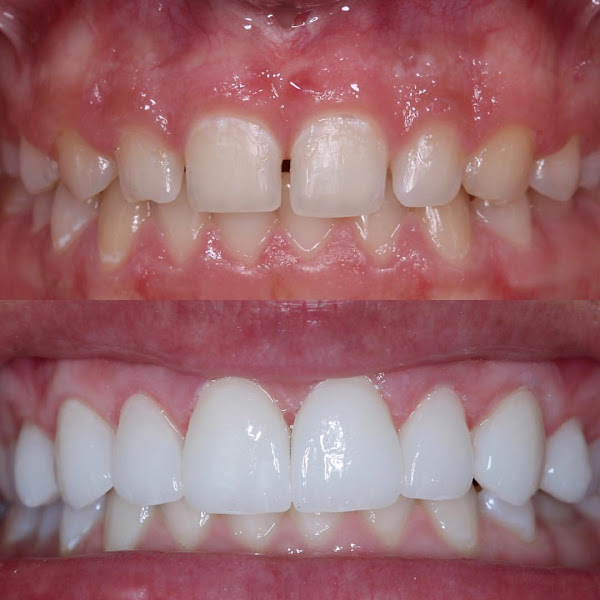 Foto 3 de Dr. Cristiano Belem Odontologia | Implantes e Ortodontia