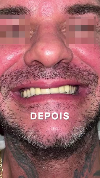 Foto 4 de Dr. Cristiano Fiori: Dentista em Limeira