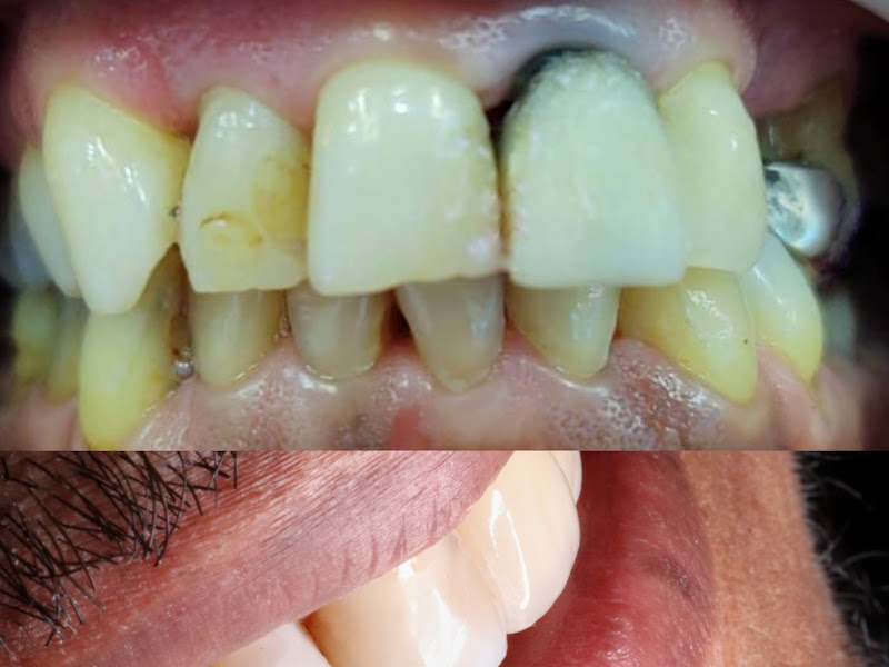 Foto 9 de Dr. Cristiano Leite Praça Filho, Dentista