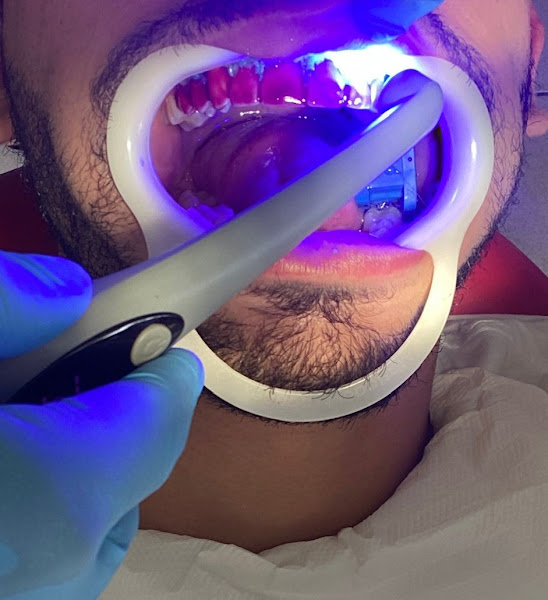 Foto 3 de Dr. Daniel Casado - Cirurgião Dentista