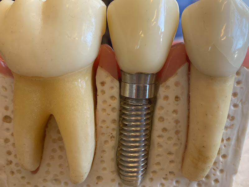 Foto 7 de Dr. Daniel Freire Dentista José Walter: Periodontia, Implantes, Prótese em Fortaleza CE