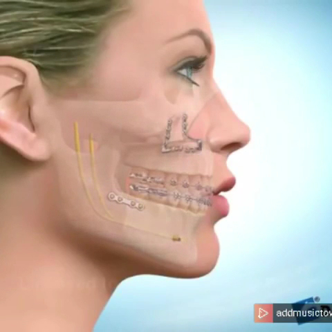 Foto 3 de DR. DANIEL HACOMAR- BUCOMAXILOFACIAL