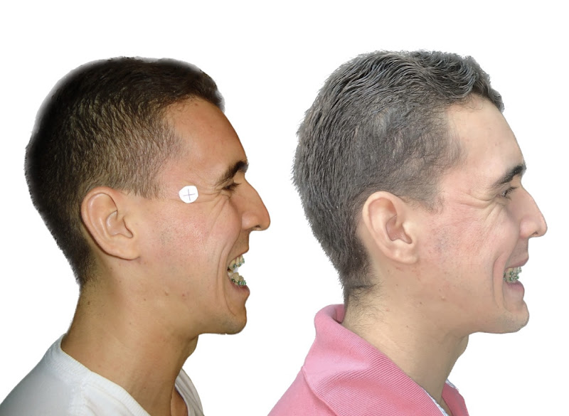 Foto 3 de Dr. Danilo Castanha - Bucomaxilofacial