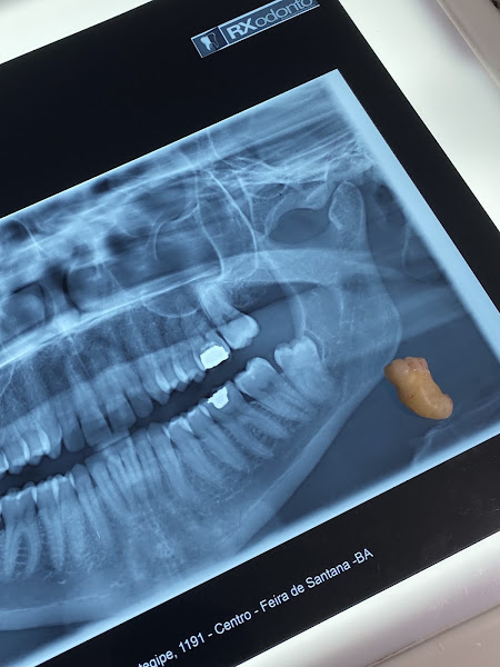Foto 2 de Dr. Danilo Moura - Odontologia Avançada