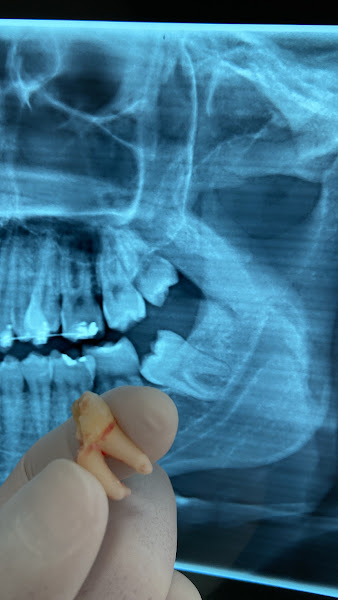 Foto 3 de Dr. Danilo Moura - Odontologia Avançada