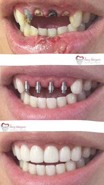 Foto 3 de Dr Darcy Mavignier Odonto24h