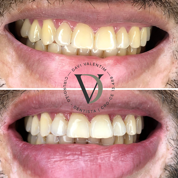 Foto 2 de Dr. Davi Valentim