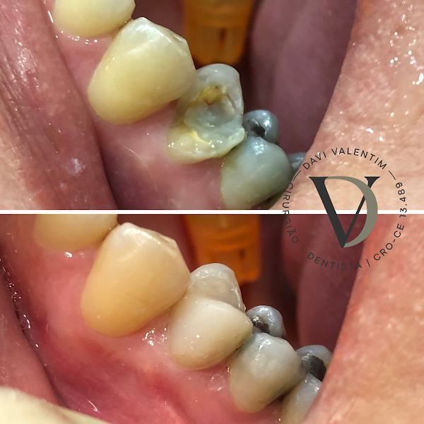 Foto 3 de Dr. Davi Valentim