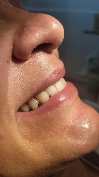 Foto 3 de Dr Denicio Calixto Implantes em Arapiraca