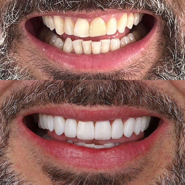 Foto 3 de Dr Di Migueli | Odontologia - Estética Dental e Implantes