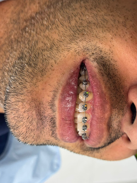 Foto 3 de Dr Diego Dutra - NDClinic Macapá - Odonto e Harmonização Facial