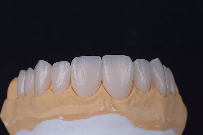 Foto 4 de Dr Diego Dutra - NDClinic Macapá - Odonto e Harmonização Facial