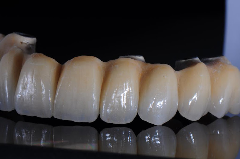 Foto 2 de Dr. Diego Fontes DenteClínic