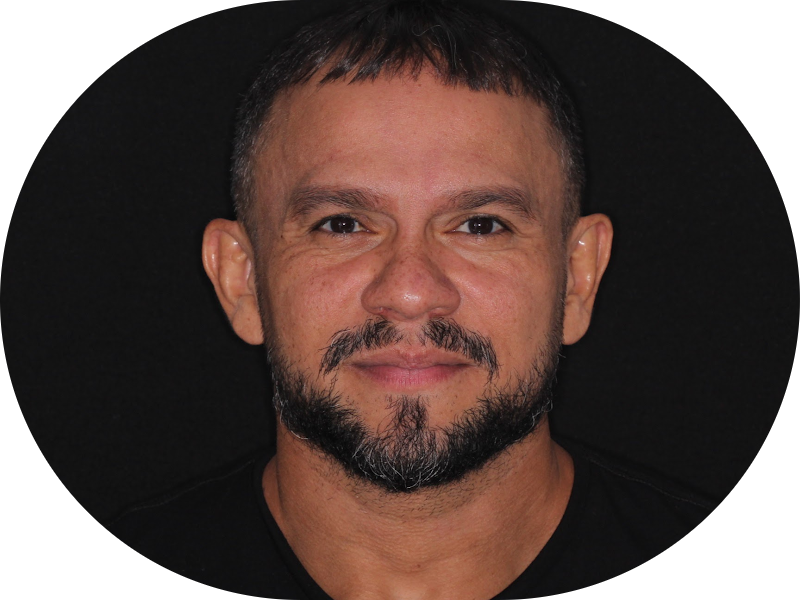 Foto 6 de Dr. Diego Mendes - Especialista em estética em Fortaleza