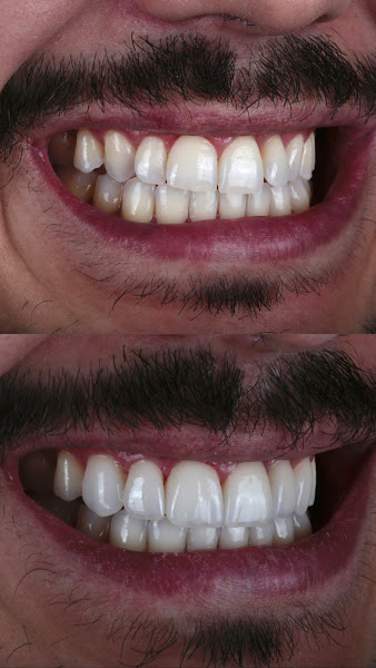 Foto 2 de Dr. Diego Queiroz – Dentista em Goiânia