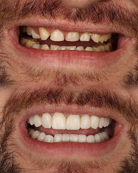Foto 2 de Dr. Dieison Dahmer Odontologia Estética