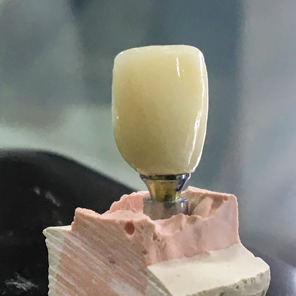 Foto 3 de Dr. Djacy Ribeiro