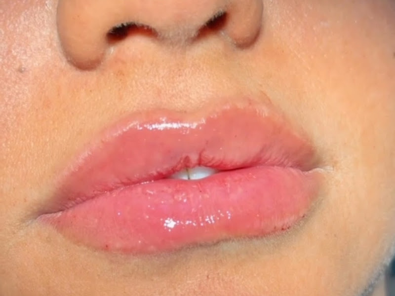 Foto 2 de Dr. Domingo Buoso Jr - Dentista