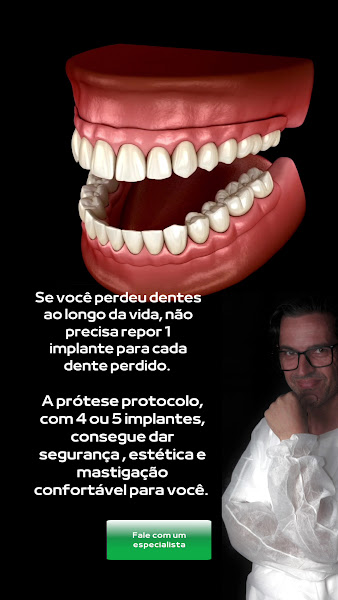 Foto 4 de Dr Douglas Lima | Implantodontista em São José SC