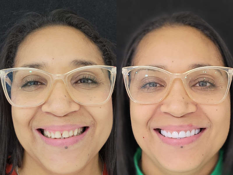 Foto de Dr. Douglas Ricceri - Facetas em Resina Composta, Clareamento Dental e Clínico-Geral