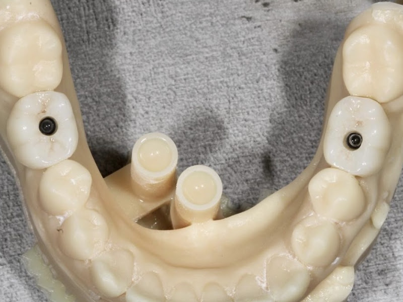 Foto 3 de Dr. Douglas Voss DDS, MSc, PhD. Cirurgião Bucomaxilo e Implantodontista.