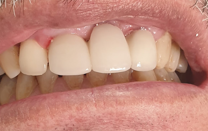 Foto 2 de Dr. Durval Capp FIlho Dentista em Santos CRO 371