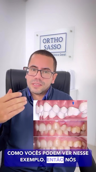 Foto 3 de Dr. Éberson Sasso - Ortodontia | Invisalign | Porto Alegre