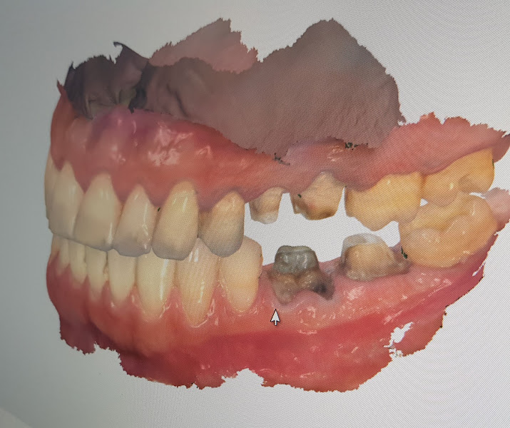 Foto 2 de Dr. Edinaldo Caires - Prótese e Implantes