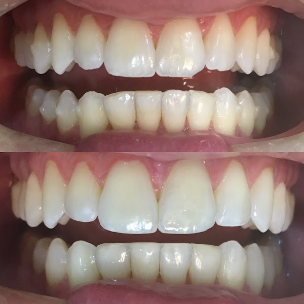 Foto 3 de Dr. Eduardo Andreoli Balen