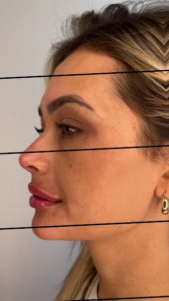 Foto 3 de Dr. Eduardo Coutinho - Harmonização Facial Avançada