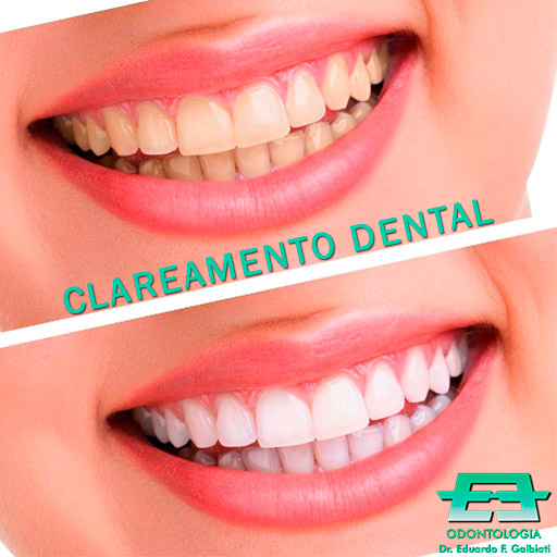 Foto 3 de Dr. Eduardo F. Galbiati - Implantes dentários e Invisalign