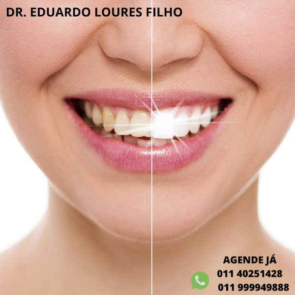 Foto 3 de Dr. Eduardo Loures Filho - Dentista 24 horas - Itu - SP