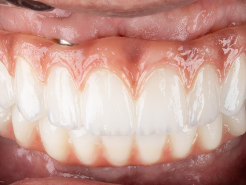 Foto 3 de Dr Eduardo Lucena Implantes Dentários