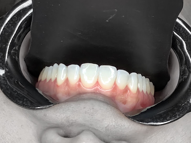 Foto 2 de Dr Eduardo Teixeira Implante Salvador