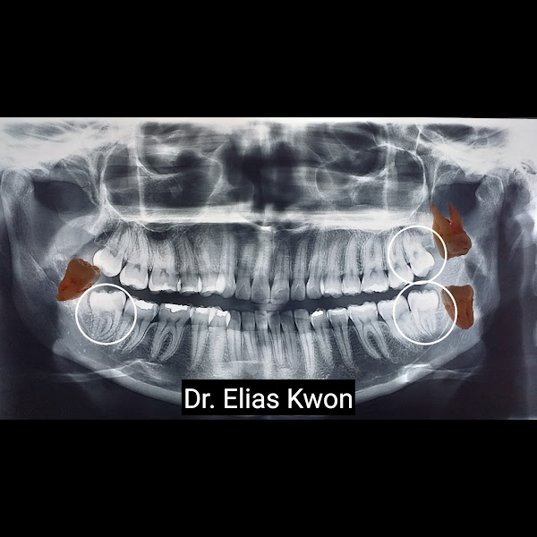 Foto 3 de Dr. Elias Kwon - 권 치과