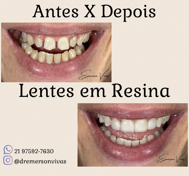 Foto 3 de Dr. Emerson Vivas Dentista em Botafogo | Clínica Odontológica em Botafogo Dr. Emerson Vivas