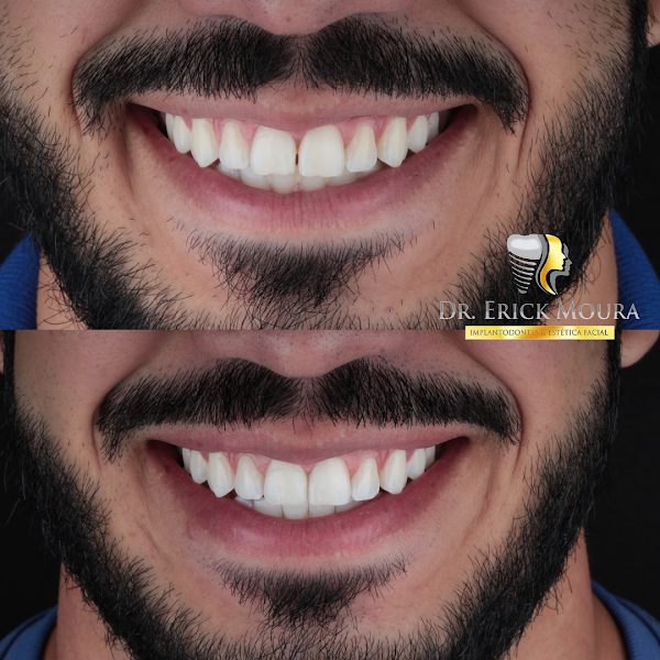 Foto 2 de Dr Erick Moura