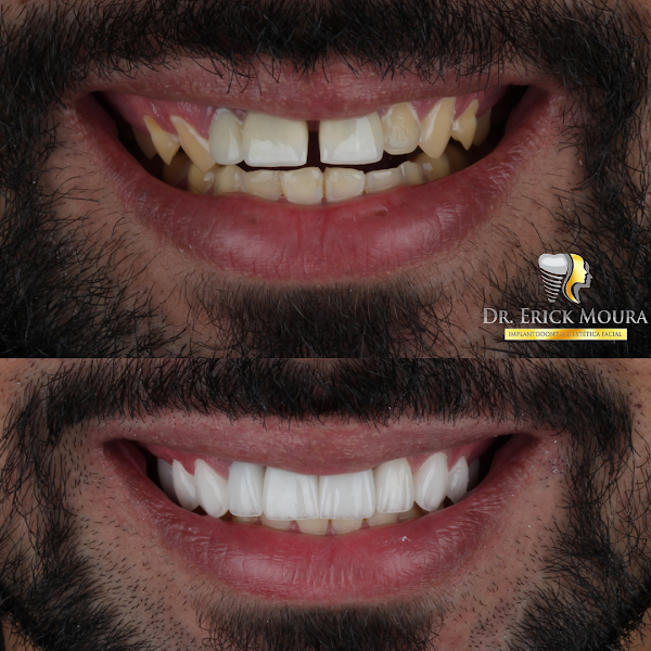 Foto 3 de Dr Erick Moura