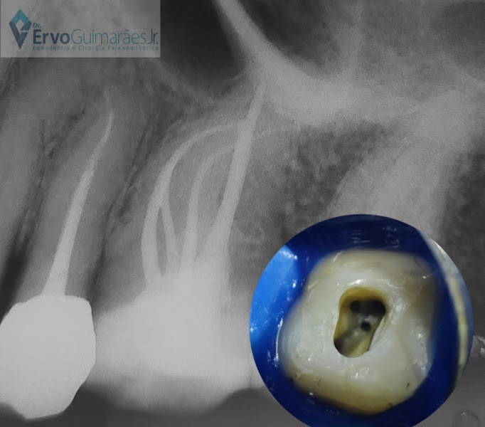 Foto 3 de Dr. Ervo Guimarães Jr - Endodontia Microscópica